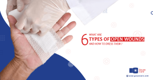 What Are 6 Types of Open Wounds and How to Dress them?