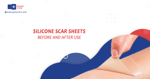 Silicone Scar Sheets Before and After Use for Wounds
