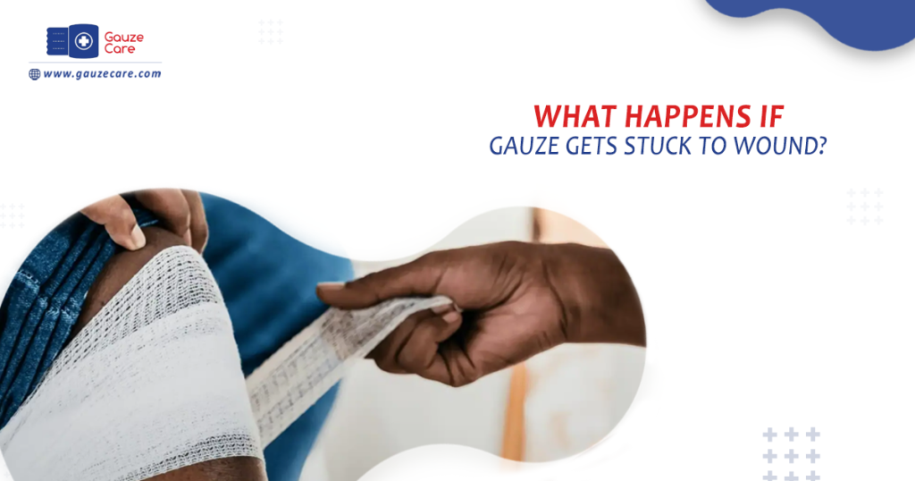 What Happens If Gauze Stuck to Wound
